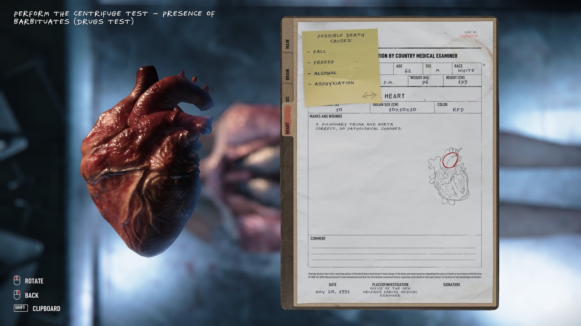 https://images.2game.com/screenshot/autopsy-simulator-buy-cdkey-full-3.jpg